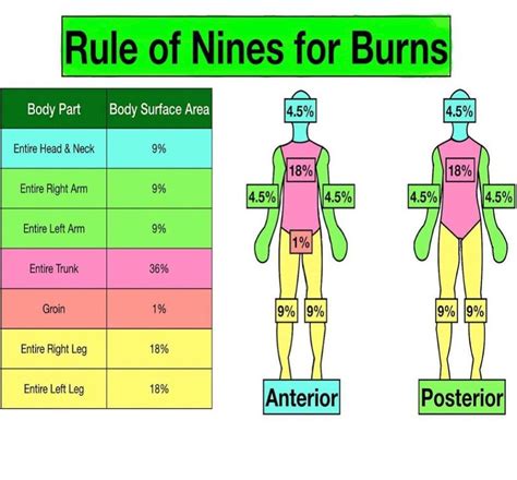 Rule Of 9s Burn Chart
